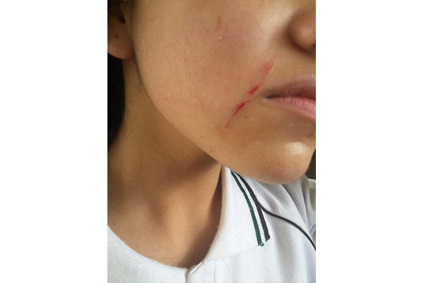 PELEA-2