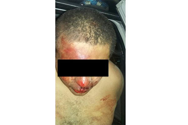 ASESINO-1
