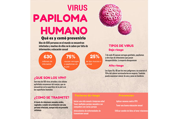 IMSS